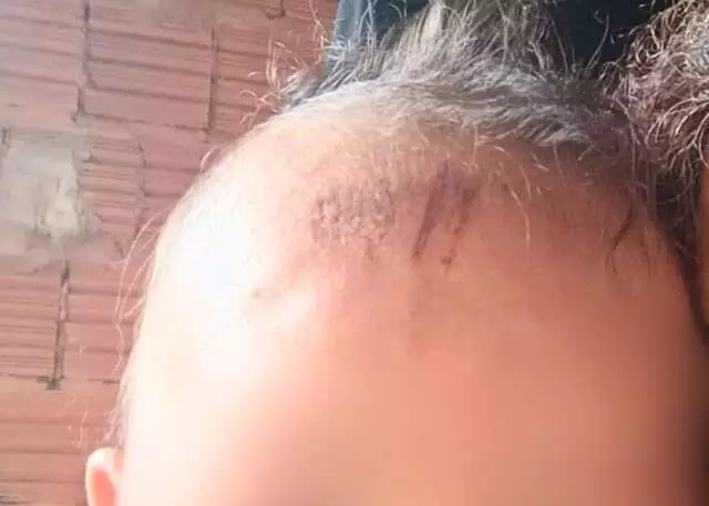 Bebê de 4 meses sobreviveu ao atropelamento por motorista bêbado