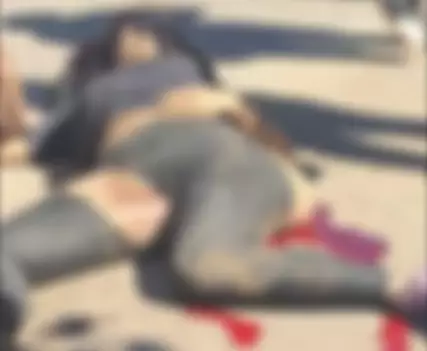 Mulher fica em estado grave após ser atropelada por ônibus em Bonito