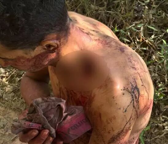 Homem é esfaqueado nas costas durante briga no rio no MS